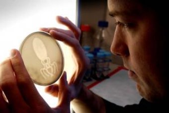   E.coli  ""   E.coli